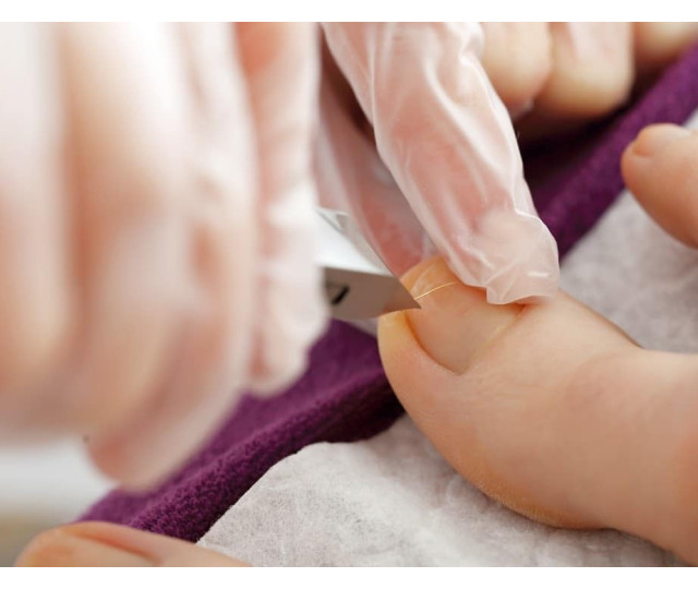 Jak zapobiegać wrastaniu się paznokci u stóp?